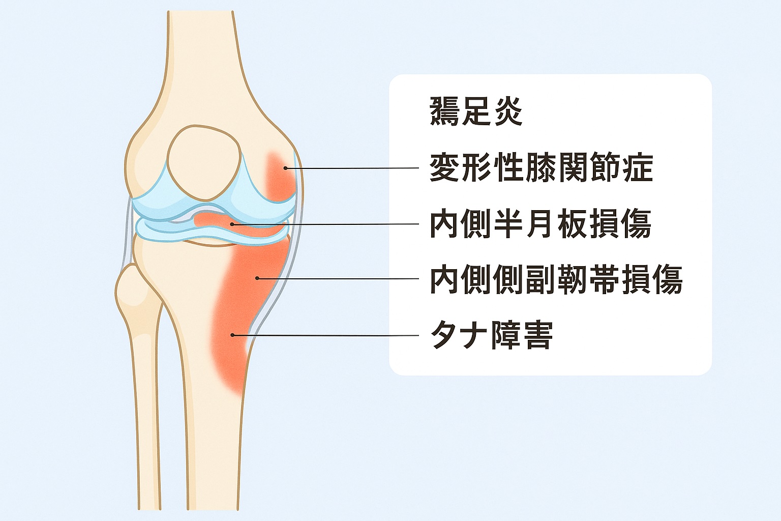 膝の内側が痛い原因・対処法まとめ|症状パターン別チェックとセルフケア完全ガイド - 整体ライフ