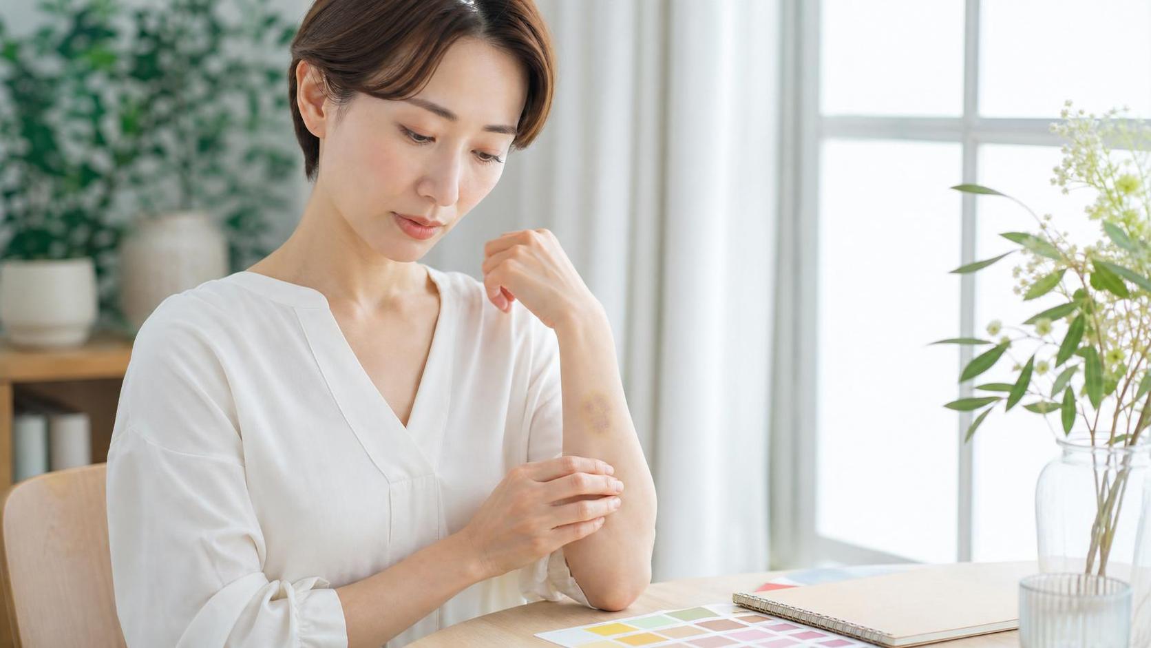 あざの仕組みとは？できる原因と色が変わる理由を解説
