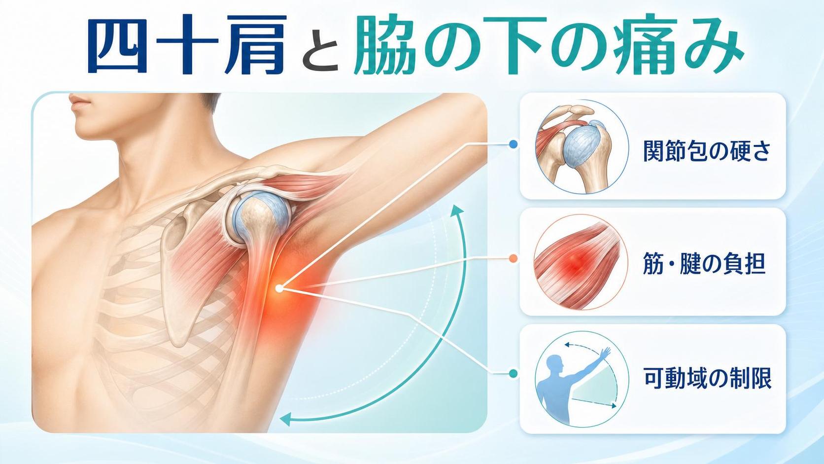 四十肩 脇の下の痛みで考えられる主な原因