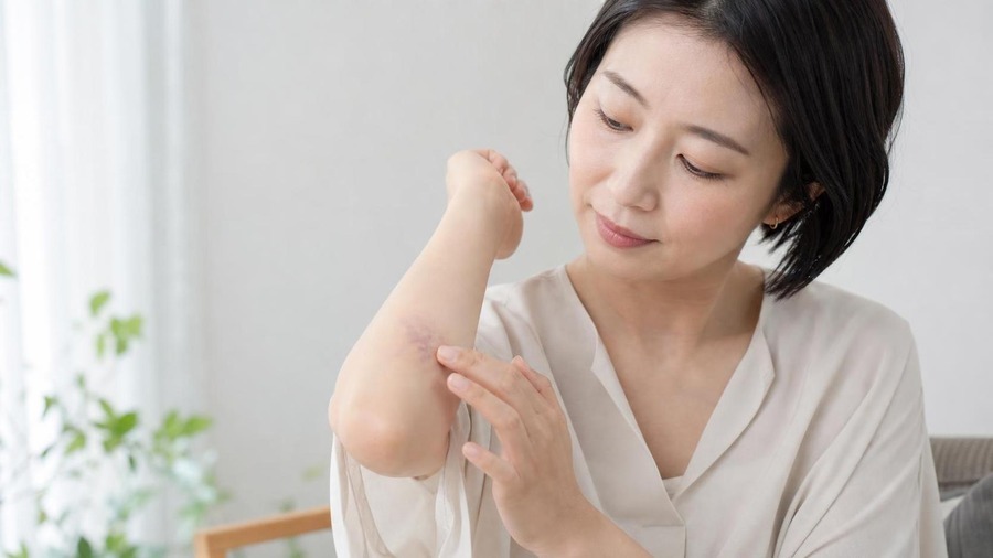 紫のあざ 治し方で最初に確認する原因