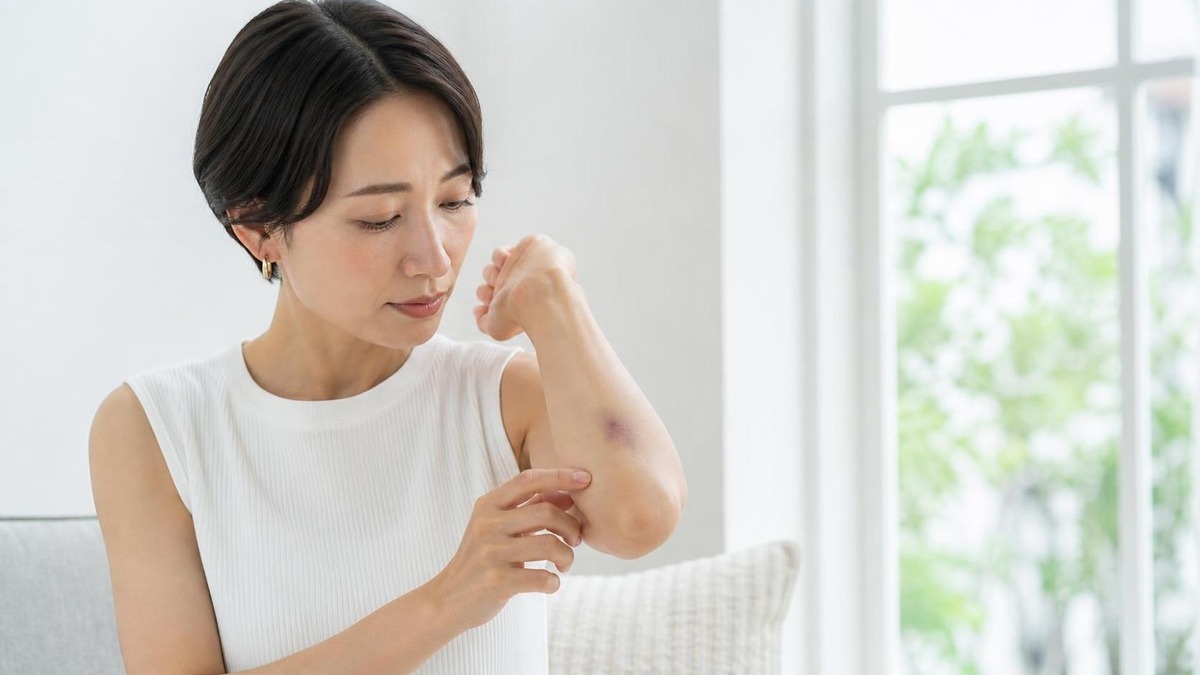 紫のあざ 治し方|内出血のケアと早く相談すべき症状