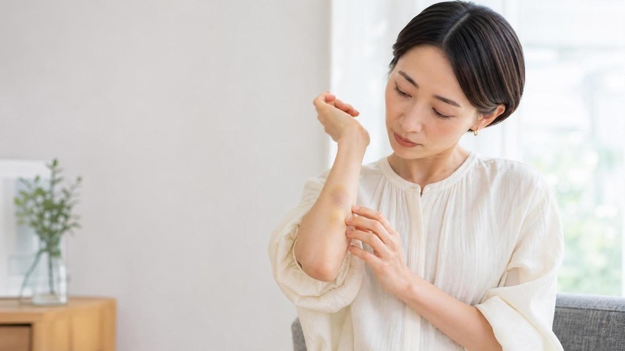 あざの回復過程で起こる皮膚の変化