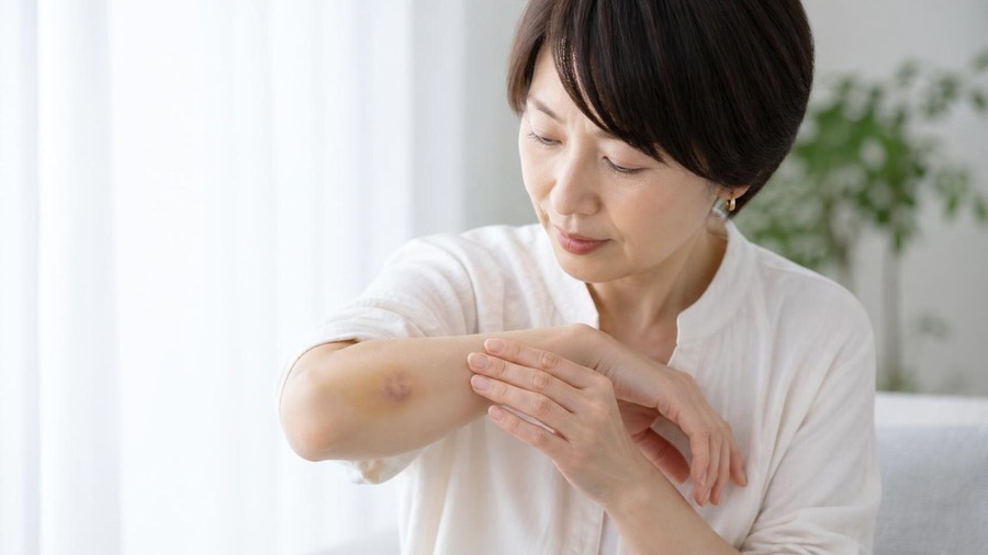 掻かずにできるケアと注意点