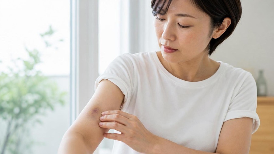 増える・消えない・出血しやすい時の受診目安