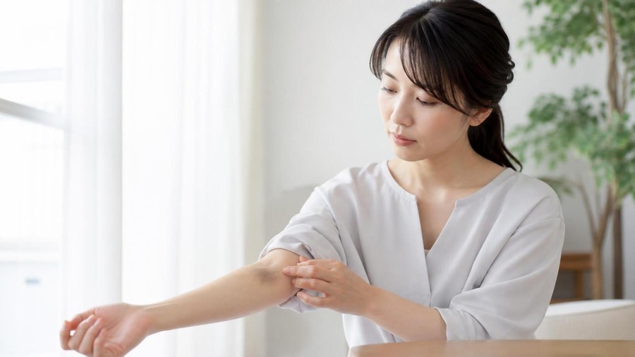 あざが治らない時の期間と色の確認